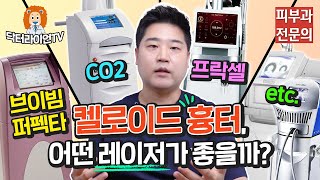 비후성반흔, 켈로이드의 첫번째 치료. 병변내 주사 비용 (수술 후 흉터 가려움)[아문TV]