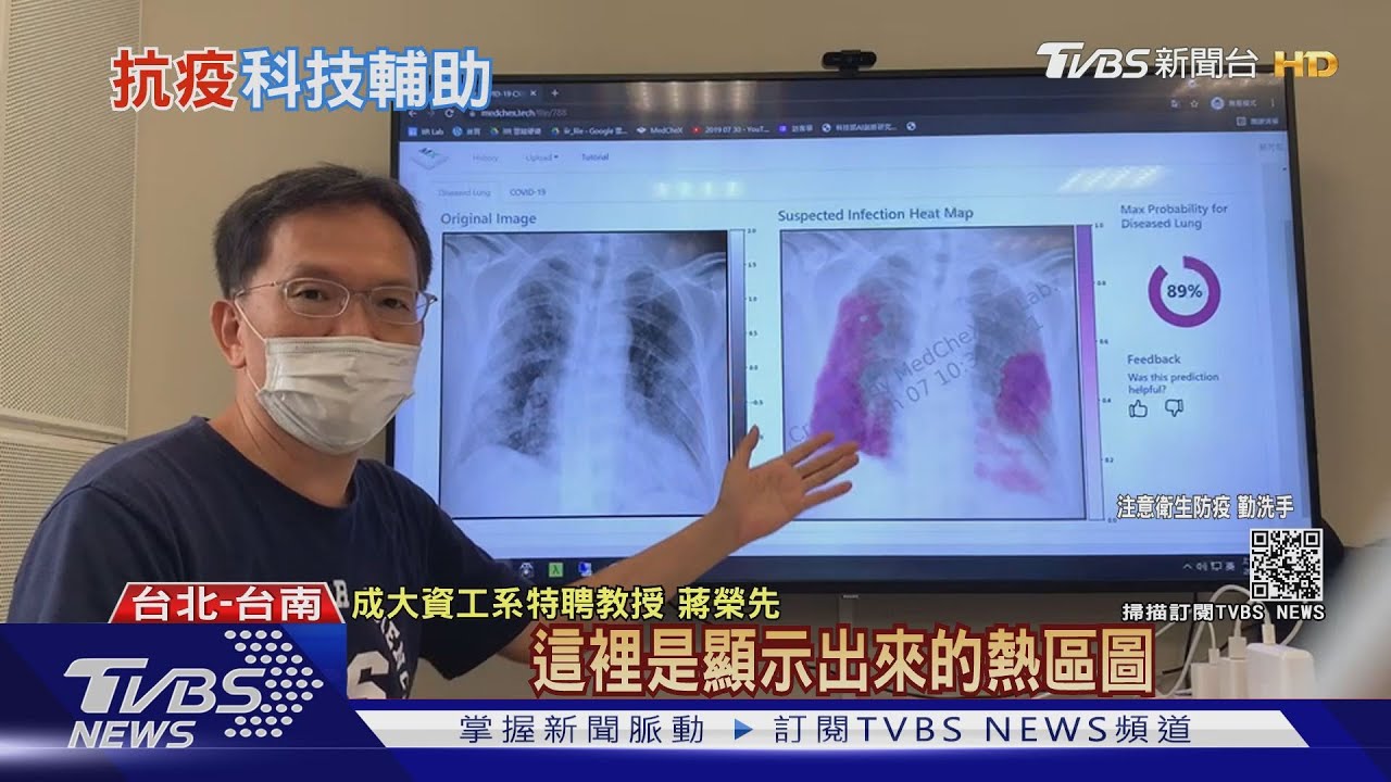 比快篩還快、一秒判斷確診！　台灣AI技術讓61國採用