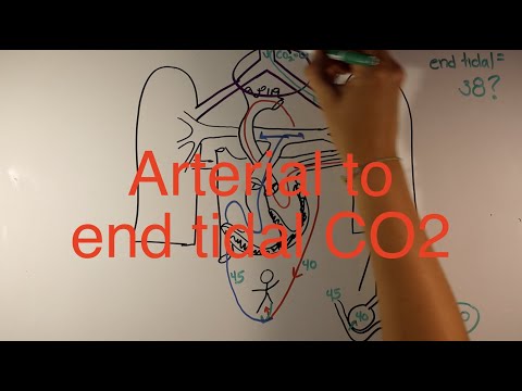 End tidal to arterial CO2 difference in CHD