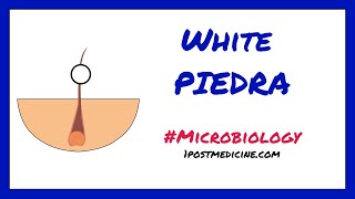 White Piedra // Microbiology