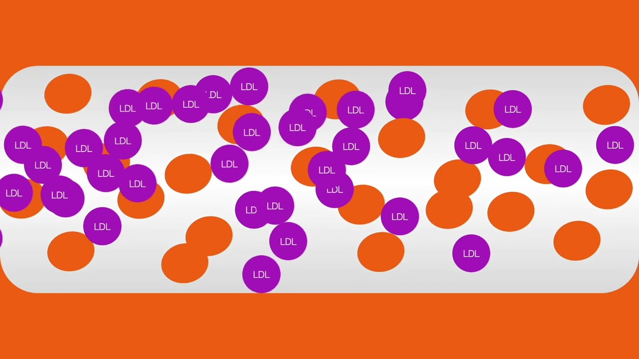 Olive Oil and Multiple Sclerosis