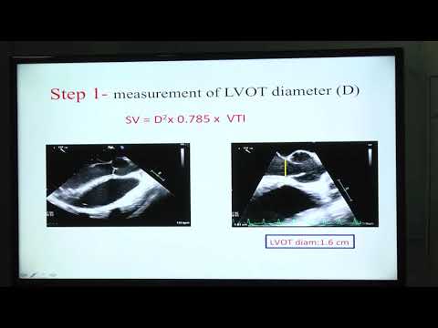 20180822_14_ Haemodynamic Calculations_ Debika_Chatterjee_Dr