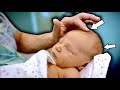 THIS NEWBORN HAS 2 HOLES IN HIS SKULL! (Fontanelle) | Dr. Paul