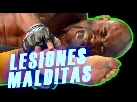 😱TERRIBLE INJURIES in UFC, the WORST INJURIES of UFC fighters.