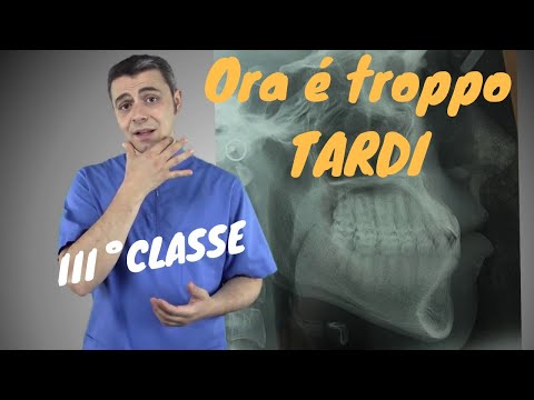 Ora è troppo tardi - la III classe -