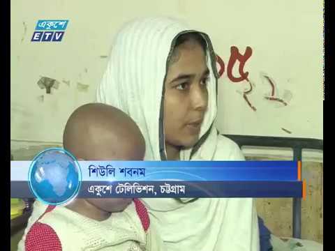 চমেক হাসপাতালে তিন বছর ধরে বিকল রেডিওথেরাপি মেশিন