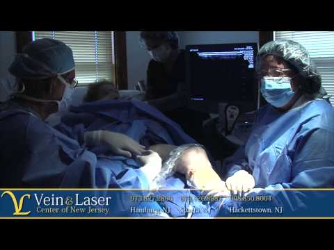 Vein and Laser Center of NJ - Radio Frequency Ablation Varicose Veins - Venefit