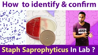 How to identify & Confirm Staphylococcus Saprophytes in Laboratory ?