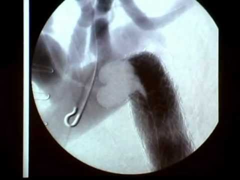 2 - XI Panamerican Congress on Vascular and Endovascular Surgery 2010 - Parte 5
