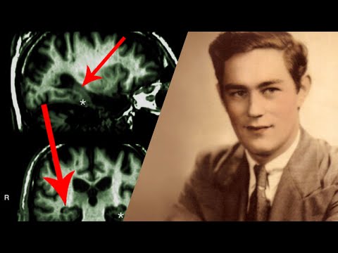 Der Mann mit dem 30 Sekunden Gedächtnis - Patient HM