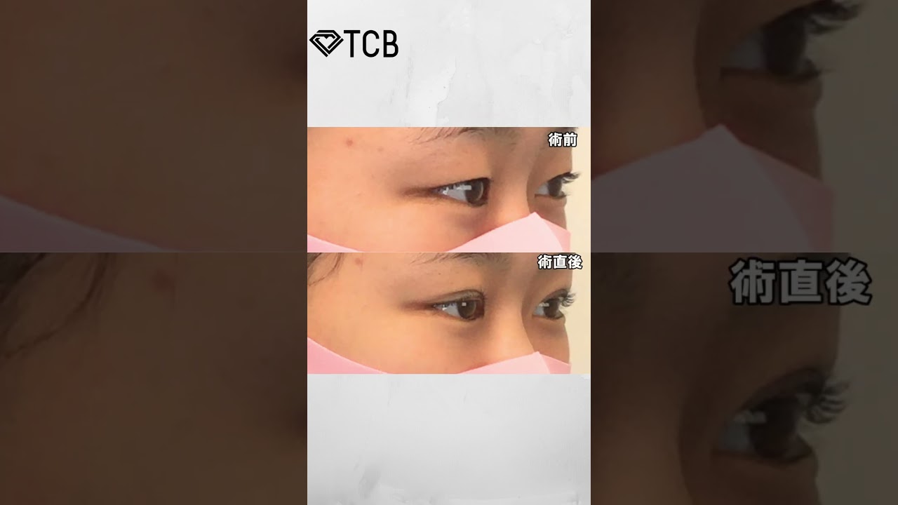 Youtubeのサムネイル