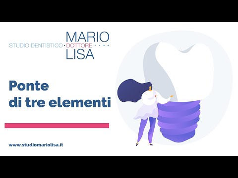 Erectum potenza recensioni vere Qual è pronta donna eccitata