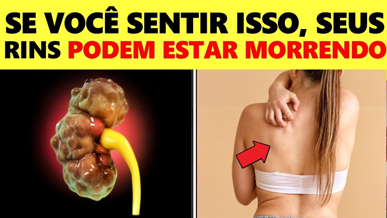 ALERTA! Este Sintoma Estranho Pode Indicar Que Seus Rins Estão MORRENDO!