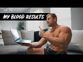 Looking at my blood work AFTER using Steroids