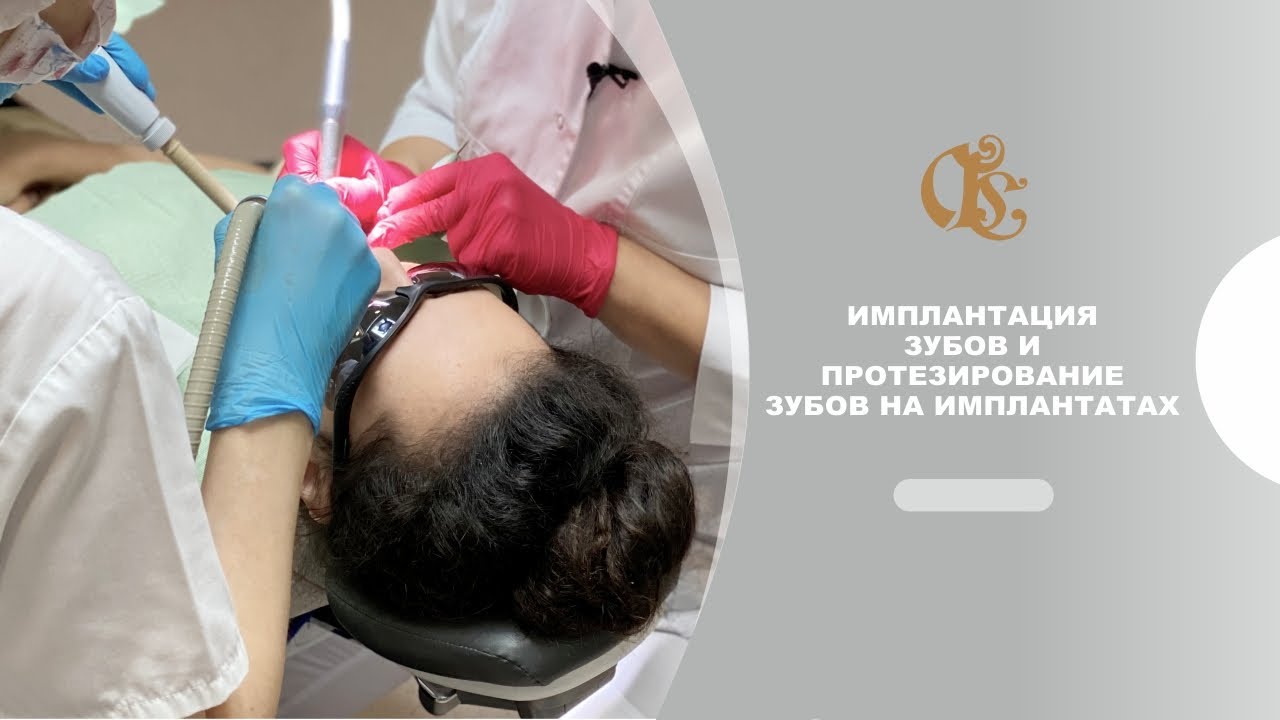 Имплантация зубов и протезирование зубов на имплантатах 