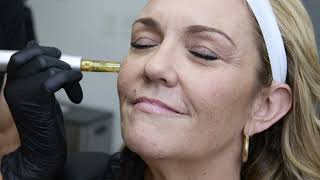 Ohm Med Spa San Diego | Advanced Aesthetic Treatments in Mission Valle