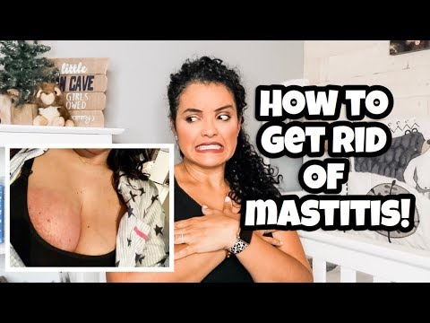 HOW TO GET RID OF MASTITIS NATURALLY / LIFEWITHLO