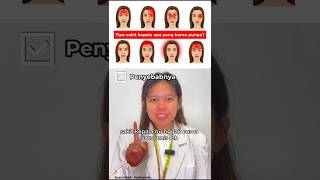 Download lagu Which type of headache have you ever experienced? #uniquefacts #education #shorts mp3 Download lagu Which type of headache have you ever experienced? #uniquefacts #education #shorts mp3