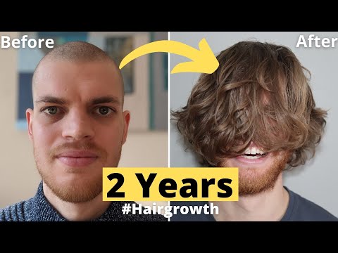 💇🏻💈Hair Growth Time Lapse 2 Years (24 Months) Men - From Buzz Cut
