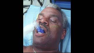 Mr. Bean effortlessly removed the shell casing, leaving all the doctors feeling ashamed. #edit