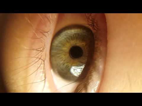 polip látási teszt hogyan lehet javítani a látás rövidlátás gyakorlását