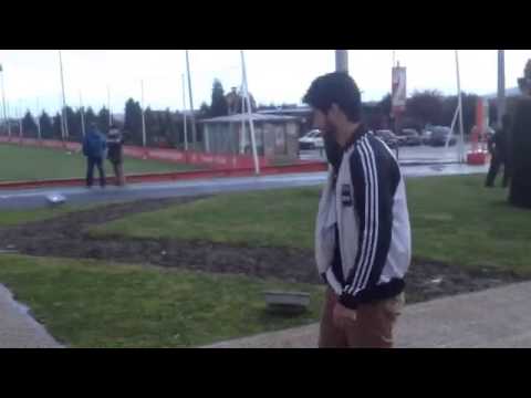 Nacho Cases camina ya sin muletas