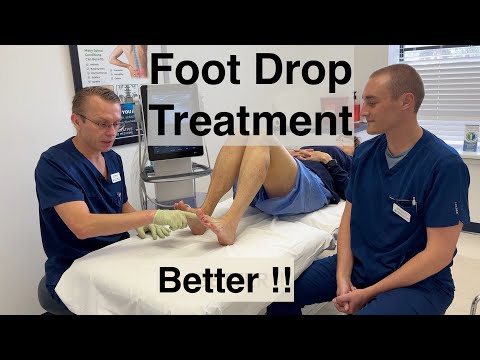 Foot Drop Treatment with Fibular Nerve Hydrodissection