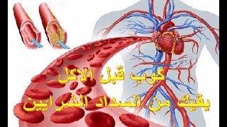 كوب واحد على الريق سيقوم يفتح و تنظيف الشرايين من الدهون المتراكمة منذ سنوات