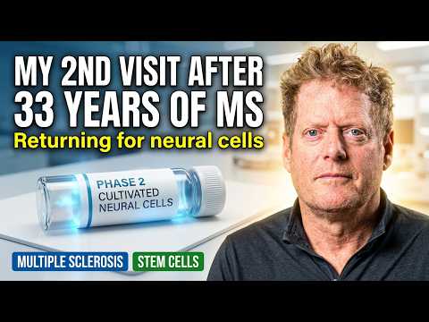 Thérapie par cellules souches pour la sclérose en plaques : retour pour des cellules neurales