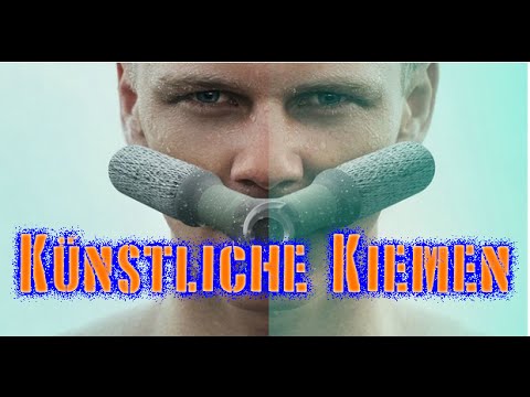 Pulmonale Hypertension, Leberzirrhose Bluthochdruck und Flüssigkeitsaufnahme