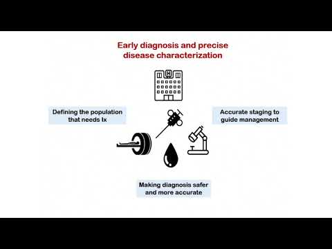 Oxford University surgical lectures: Diagnosing and managing early prostate cancer