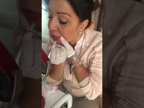 Succo da pigmentazione su una faccia Siero di cliniche di posti di pigmentary
