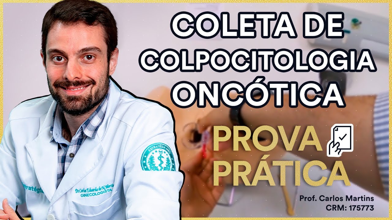 Coleta de Colpocitologia Oncótica (exame de Papanicolau) na Prova Prática de Ginecologia