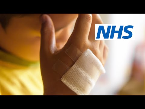 How do I deal with burns and scalds? (9 to 30 months) | NHS