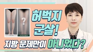 [ENG SUB] 절대 안 빠지는 허벅지 다이어트, 마른 사람도 사이즈 감소가능!