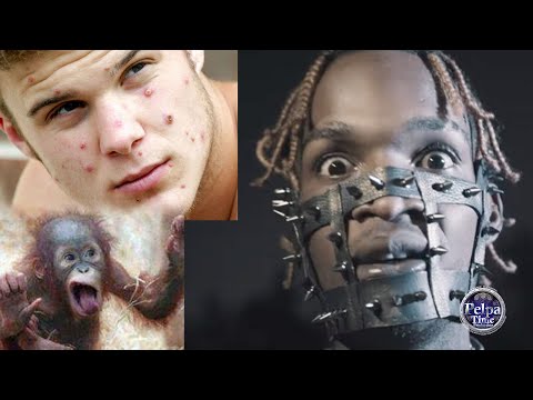 SKENG arrested for BLEACHING CREAM  /IS MONKEYPOP in JAMAICA?