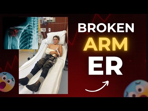 Broken Arm Emergency! MX Crash