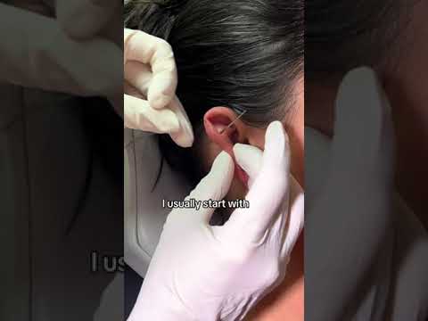 Helix-Piercing-Pflege mit dem Piercing Aftercare Spray von Base Laboratories! Schnellere Heilung ...