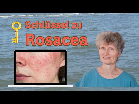 Rosacea - was steckt hinter diesem roten Hautausschlag?