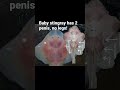 Baby stingray has 2 penis, no legs!