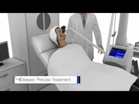 UltraPulse ® With SCAARFX - The Most Advanced CO2 Laser System | Lumenis