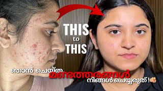 Download lagu Real Acne Recovery Story (2022–2026)💯| Diet for Oily Skin & My Healing Process🥗 | Henna Enn mp3 Download lagu Real Acne Recovery Story (2022–2026)💯| Diet for Oily Skin & My Healing Process🥗 | Henna Enn mp3