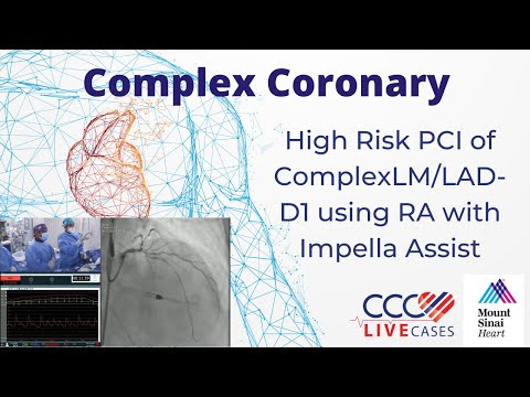 High Risk PCI of Complex﻿LM/LAD-D1 using RA with Impella Assist