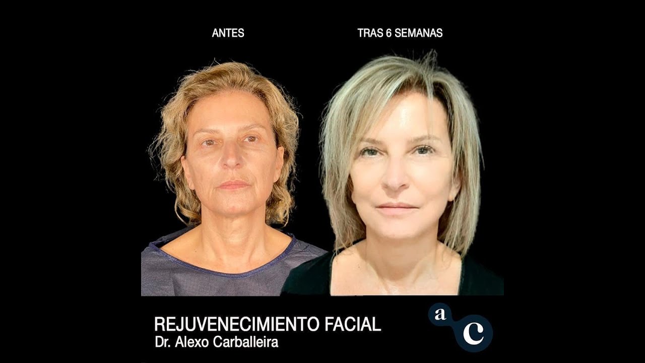 Alexo Carballeira Braña-17