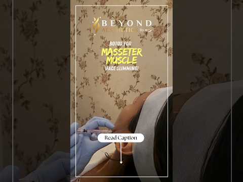 Benefits of Botox for Masseter Muscle (Face Slimming) 