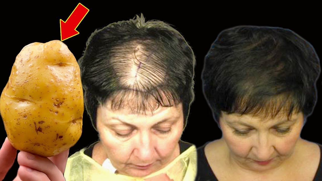 Hair grows like crazy and doesn't fall out! This is the most powerful recipe! (Did you know that?)