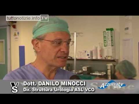 Della prostata è la calcificazione Follicoli della prostata