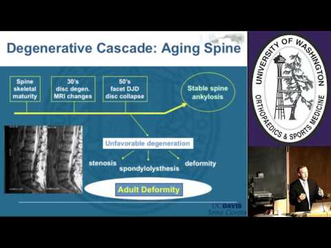 Grand Rounds - Spinopelvic Parameters - October 2016