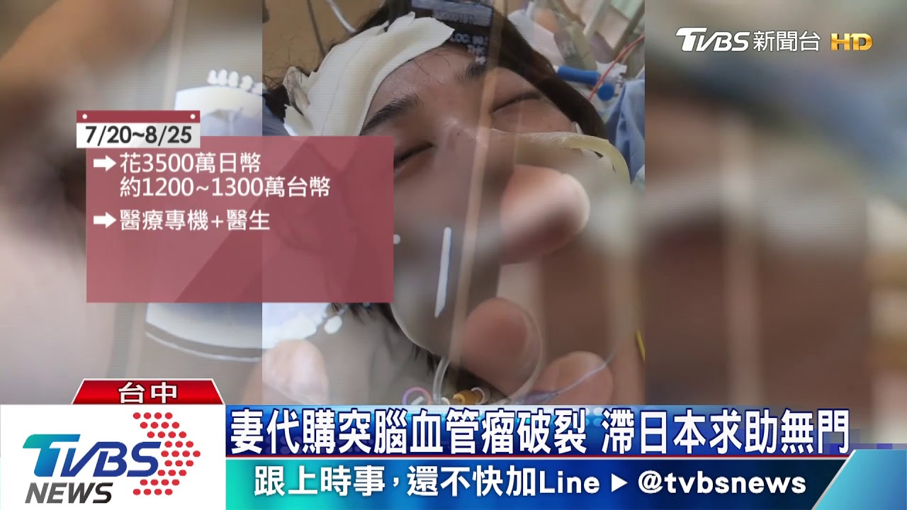 妻代購突腦血管瘤破裂 滯日本求助無門