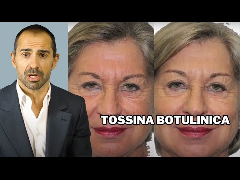 Paraffini il pacco di faccia e le mani contro rughe Crema di cliniche da rughe intorno a risposte di occhi